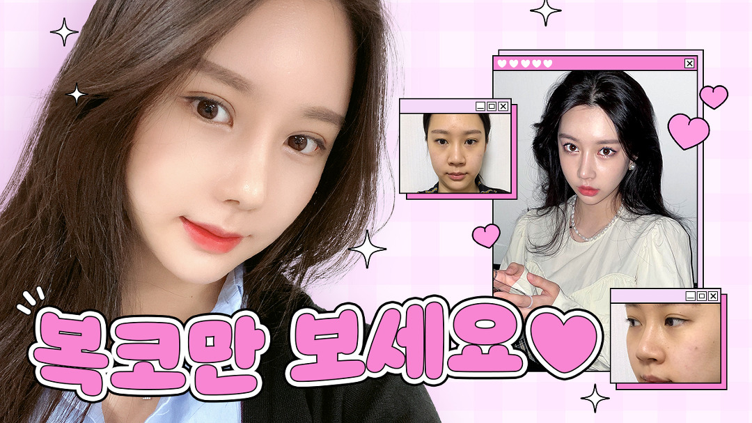 l 디에이성형외 - kakaoTV 복코수술 고민된다면 필수 시청👃🏻 l 콧볼축소,코필러 녹이기, 절골 l 디에이성형외
