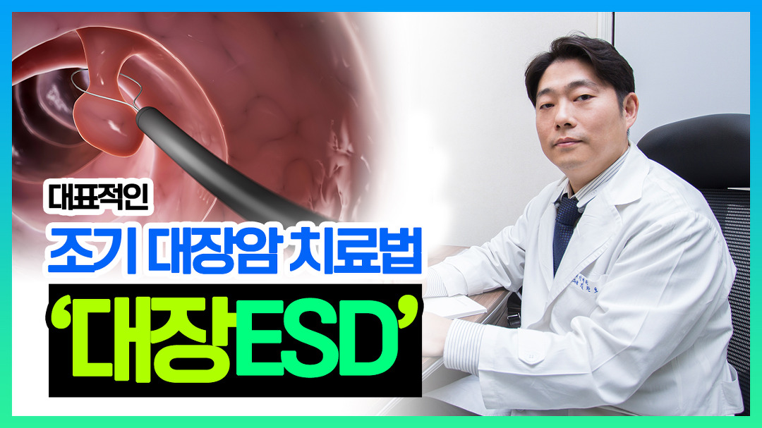 대표적인 조기 대장암 치료법 대장ESD (세강병원 김찬호 원장) - kakaoTV  대표적인 조기 대장암 치료법 대장ESD (세강병원 김찬호 원장)