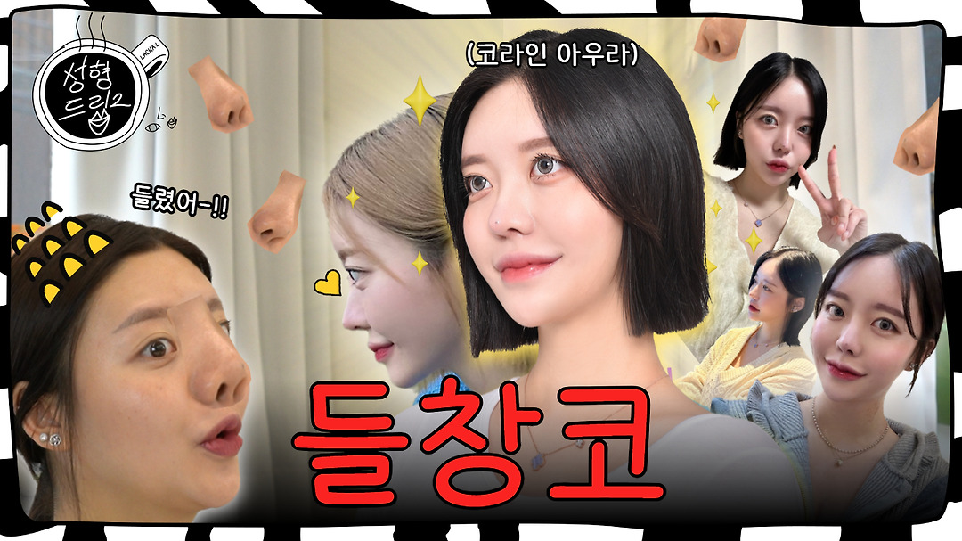 들창코의 최고봉 코수술 방법 알려드립니다. | EP.01 코(샌드플란트)... 들창코의 최고봉 코수술 방법 알려드립니다. | EP.01 코(샌드플란트) 