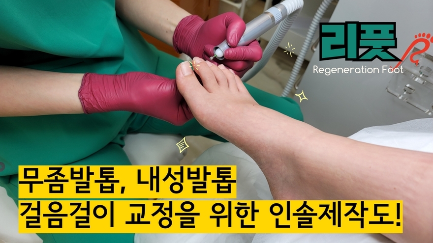 통영 내성발톱, 무좀발톱? 맞춤케어 리풋에서! - kakaoTV 통영 내성발톱, 무좀발톱? 맞춤케어 리풋에서!