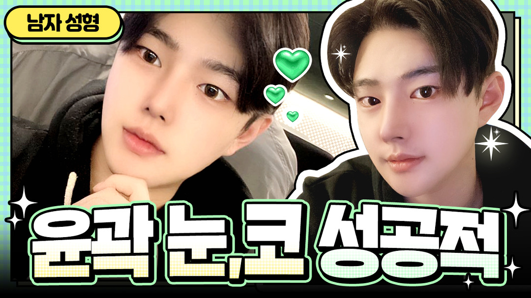 l 디에이성형외과 - kakaoTV 남자 코성형, 콧볼 축소, 매부리코 l 윤곽3종, 눈매교정, 남자 트임 l 디에이성형외과